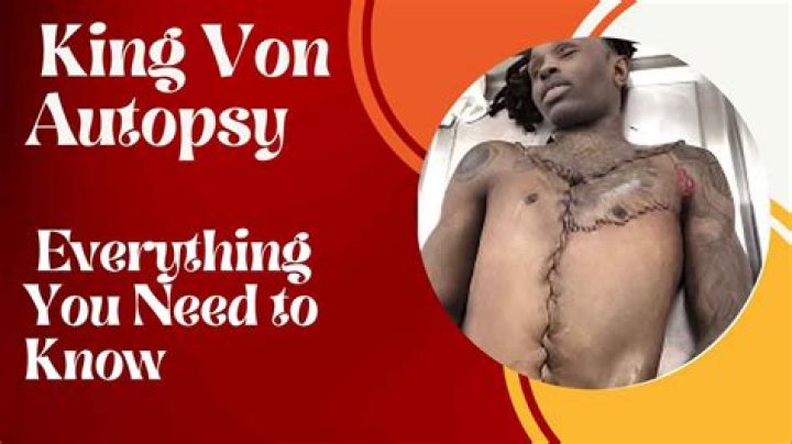 King Von Autopsy Report: Uncovering The Unseen
