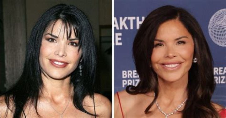 Unveiling Sherlyn Chopra's Plastic Surgery Journey: Discoveries And Insights