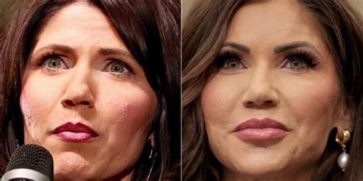 Unveiling The Secrets Of "Noem Before And After": A Transformative Skin Journey